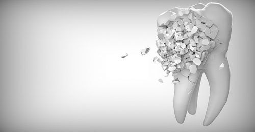 tooth-2874551_640